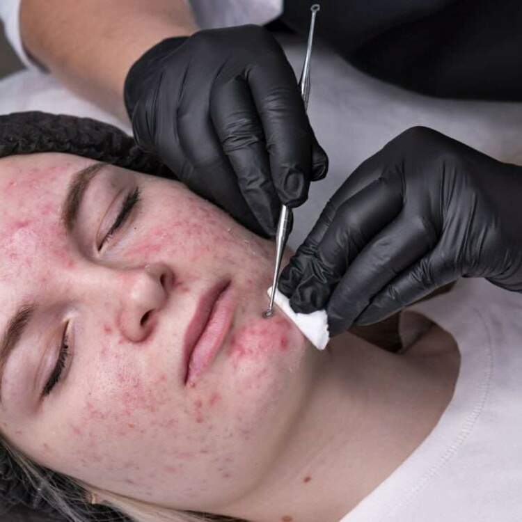 Экспертный цикл: Косметологический консилиум.  Терапия акне: эффективные решения